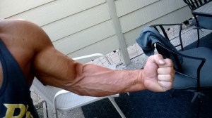 Forearm veins